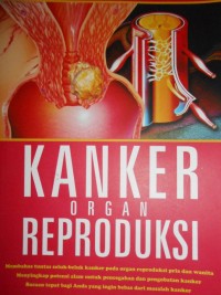 Image of Kanker Organ Reproduksi